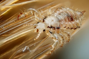 head louse