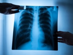 Specialist doctor examining x-ray film of patient.
