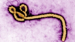Ebola is a rare, but serious and often deadly, disease caused by the Ebola virus.