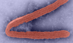 marburg virus